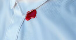 remove blood stain effectively